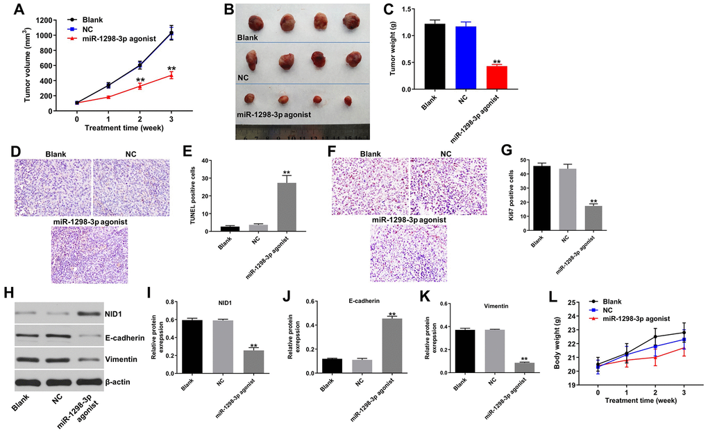 Upregulation of miR-1298-3p inhibits tumorigenesis of U87MG subcutaneous xenografts in vivo. U87MG cells were subcutaneously injected into nude mice, and 50 nM miR-1298-3p agonist was directly injected into the tumors twice a week. (A) Xenograft tumor volume was monitored weekly. (B, C) Xenografts tumors were photographed and calculated. (D, E) TUNEL assay of apoptosis in tumor tissues. (F, G) IHC assay of proliferation in tumor tissues. (H) Protein levels of NID1, E-cadherin, and vimentin in tumor tissues analyzed by western blotting. (I–K) The relative expression of NID1, E-cadherin, and vimentin in tumor tissues quantified, and normalized to β-actin. (L) The body weights of mice were monitored. **P 