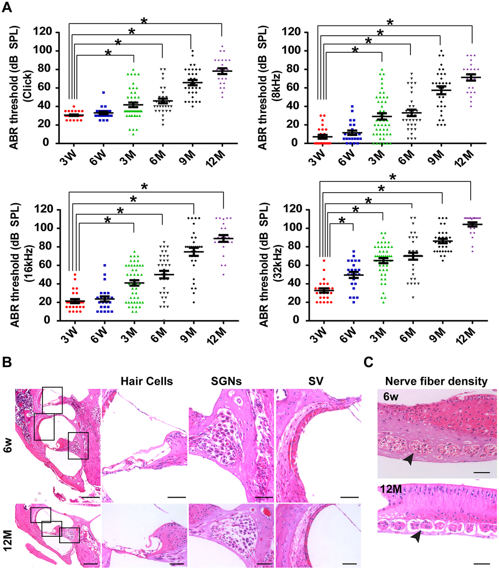 C57BL/6J mice as the animal model of AHL. (A) Elevation in auditory brainstem response thresholds was observed in aging C57BL/6J mice (n = 45) at click, 8, 16, and 32 kHz. (B) H&E histology shows the development of cochlear structures and pathology as age increased. *P  0.05 compared to control; scale bars of 200 μm (left panel) and 50 μm (right panel). (C) Nerve fiber density in habenular openings at mid-basal turn in six-week-old and one-year-old B6 mice (scale bar = 50 μm).