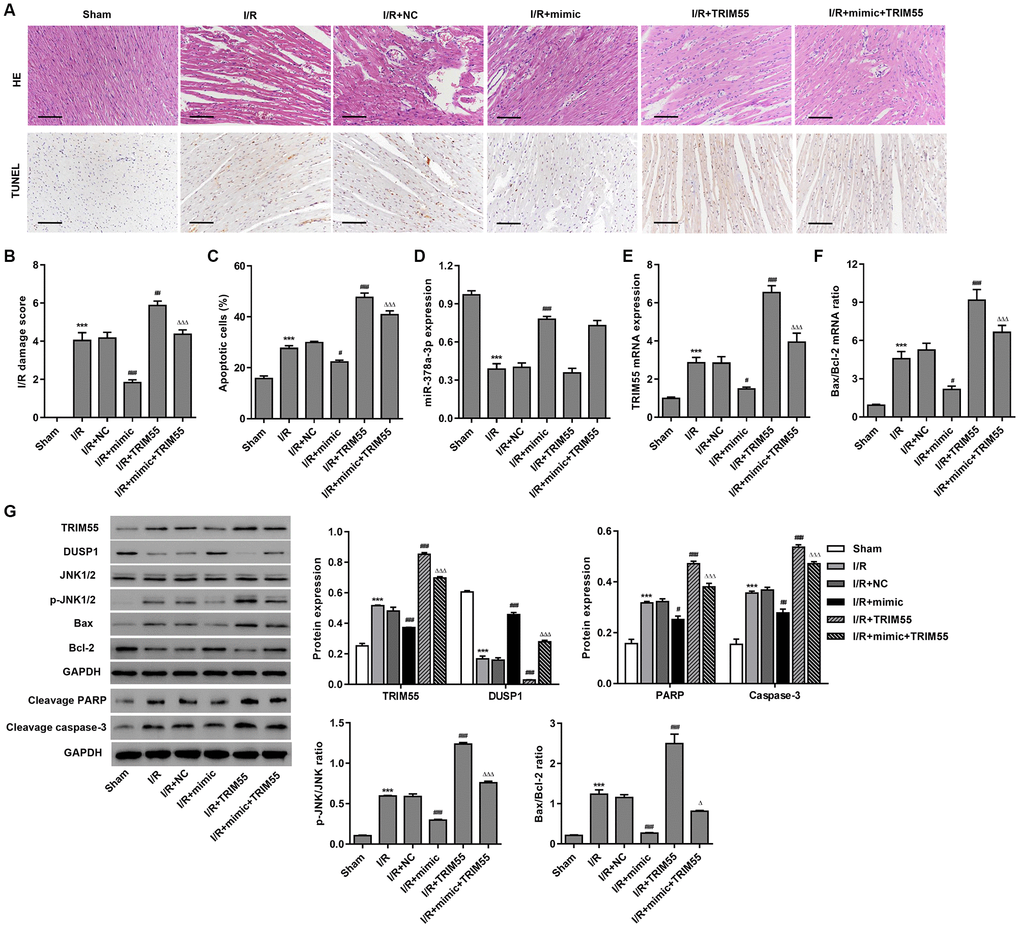 The miR-378a-3p mimic inhibits I/R-induced apoptosis in rats. Myocardial I/R model rats were injected with 50 mg/kg of the miR-378a-3p mimic or negative control (NC) 24 h before LCA ligation. (A–C) Histological assessment of the myocardium was performed by H&E staining and TUNEL. Scale bar: 100 μm. (D–F) The expression of miR-378a-3p, TRIM55, Bax, and Bcl-2 was measured by real-time PCR. (G) The expression of TRIM55, DUSP1, p-JNK1/2, JNK1/2, cleavage of PARP and caspase-3, Bax, and Bcl-2 was measured by western blotting. ***P #P ##P ###P ΔP ΔΔΔP 