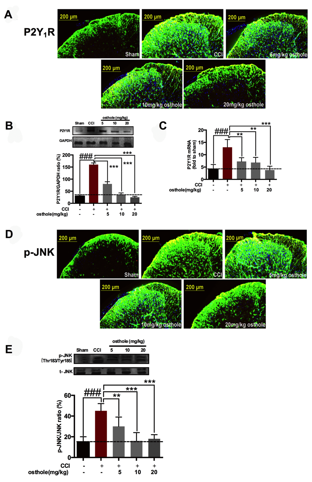 Osthole cut down P2Y1R up-regulation and p-JNK activation on a concentration-dependent manner. (A–C) Osthole decreased P2Y1R of CCI mice on a concentration dependent manner. ###pppD, E) Osthole reduced p-JNK expression after CCI in the spinal cord on POD 14. ###pppF) Osthole reduced inflammatory factors after CCI in the spinal cord on POD 14. ###pp