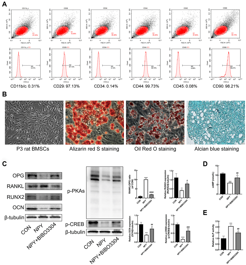 Y1R antagonist treatment reversed NPY-mediated suppression of osteogenesis and cAMP/PKA/CREB pathway in BMSCs. (A) Flow cytometric analysis of BMSC surface markers. (B) The multidifferentiation potential of BMSCs in vitro (Alizarin red S staining for osteogenic differentiation, Alcian blue staining for chondrogenic differentiation, and oil Red O staining for adipogenic differentiation). (C) Western blotting results of OPG, RANKL, RUNX2, OCN, p-PKAs and p-CREB expression in BMSCs after 3 days of incubation in osteogenic medium with NPY or NPY+BIBO3304. (D, E) The cAMP concentrations and ALP activity were measured on days 3 of incubation in osteogenic medium with NPY or NPY+BIBO3304. The data are expressed as the means ± SD. *P#P##P####P