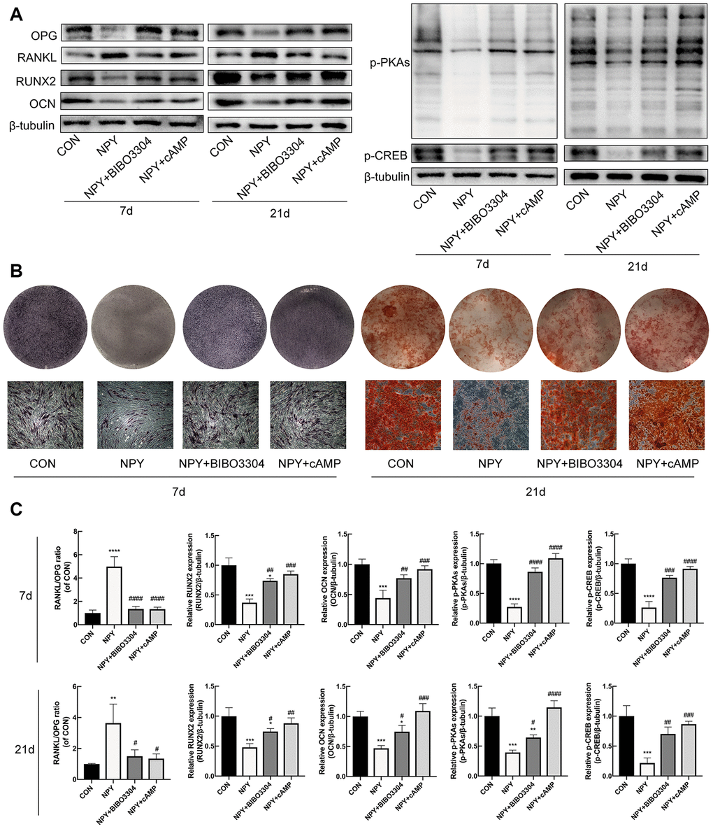 NPY inhibited osteogenesis and elevated RANKL/OPG ratio through Y1R via suppression of cAMP/PKA/CREB pathway in BMSCs. (A, C) Western blotting results of OPG, RANKL, RUNX2, OCN, p-PKAs and p-CREB expression in BMSCs after day 7 and 21 of incubation in osteogenic medium with NPY, NPY+BIBO3304 or NPY+cAMP. (B) ALP staining on day 7, and Alizarin red S staining of BMSCs on day 21 of incubation in osteogenic medium with NPY, NPY+BIBO3304 or NPY+cAMP. The data are expressed as the means ± SD. *P#P##P###P####P