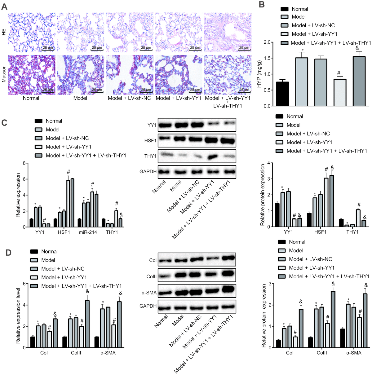 Transcription Factor Yy1 Inhibits The Expression Of Thy1 To Promote Interstitial Pulmonary 4635