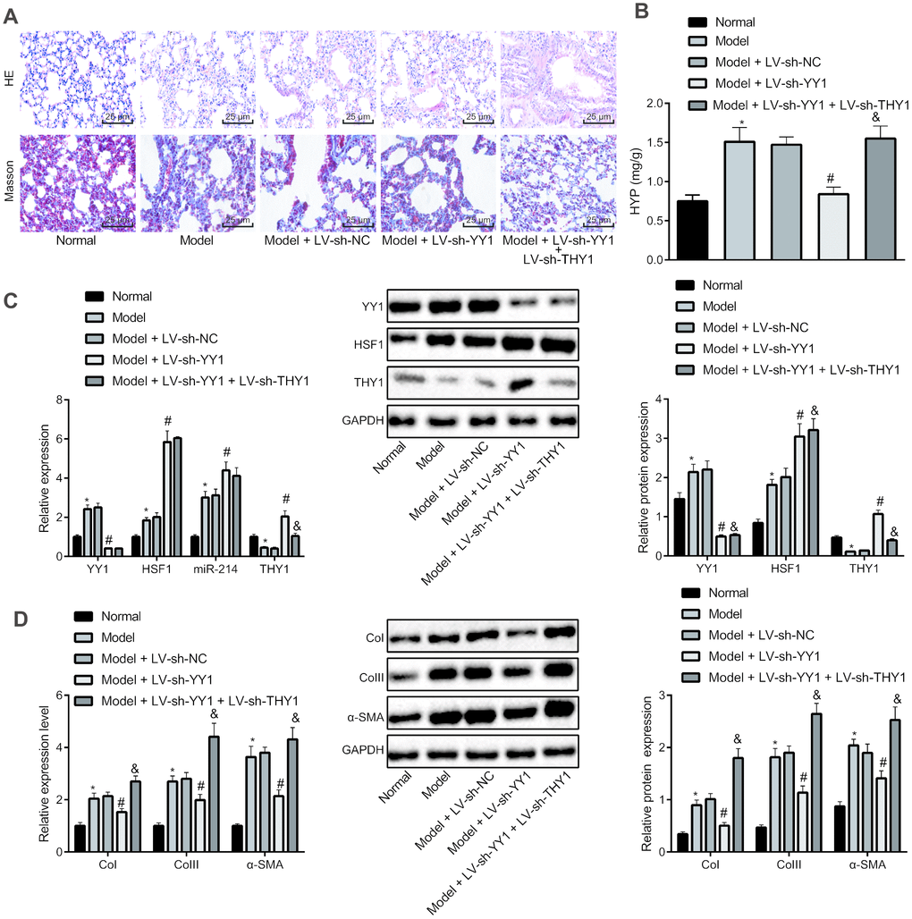 Effect of YY1/HSF1/miR-214/THY1 axis on bleomycin-induced IPF in mice. To generate a IPF model, the mice were administrated with bleomycin dissolved in normal saline on the 1st, 5th, 8th, 11th and 15th days, and infected with lentivirus (LV-sh-NC, LV-sh-YY1, LV-sh-YY1 and LV-sh-THY1 in combination) on the 24th, 26th and 28th days. (A) The pathological changes in lung tissues in mice shown by HE staining and Masson staining, respectively (400×); (B) The amount of collagen in lung tissues shown by hydroxyproline (HYP) measurement using alkaline hydrolysis assay; (C) The expression of YY1, HSF1, miR-214 and THY1 in lung tissues of mice measured by RT-qPCR, and the expression of YY1, HSF1 and THY1 proteins measured by western blot assay; (D) The expression of COI, COIII and α-SMA in the lung tissues of mice measured by RT-qPCR and western blot assay. Statistical data were measurement data, and presented as mean ± standard deviation. Comparisons among multiple groups were analyzed by the one-way ANOVA with Tukey's post hoc test. *, p vs. control mice, #, p vs. bleomycin-treated mice injected with LV-sh-NC, &, p vs. bleomycin-treated mice injected with LV-sh-YY1, n = 8.