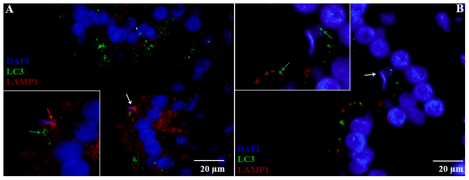 Double immunofluorescence of LC3 and LAMP1 in the epididymis of turtle. Immunolabeling of LC3 (green arrow) and LAMP1 (red arrow) during hibernation (A) and non-hibernation. (B) White arrow indicates spermatozoa interaction with apices of epididymal epithelia. Scale bar: (A, B) 20 μm.
