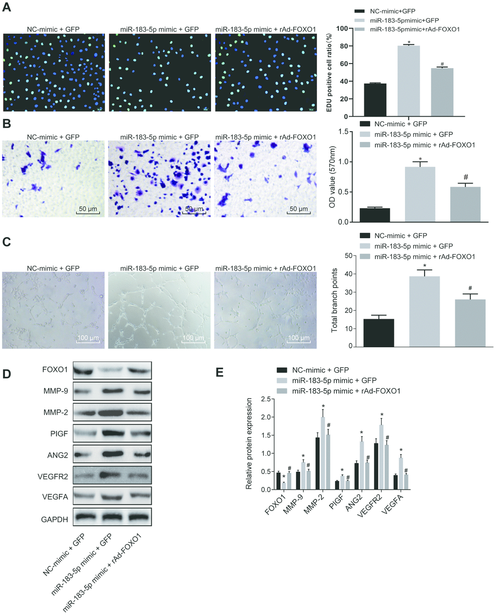 Overexpression of miR-183-5p promotes proliferation, migration and tube formation abilities of HMEC-1 cells by targeting FOXO1. (A) EdU assay was applied to detect proliferation of HMEC-1 cells after treatment of miR-183-5p mimic and rAd-FOXO1 (Scale bar = 50 μm); (B) HMEC-1 cell migration was detected by Transwell assay after treatment of miR-183-5p mimic and rAd-FOXO1 (Scale bar = 50 μm); (C) tube formation abilities of HMEC-1 cell were detected by tube formation assay after treatment of miR-183-5p mimic and rAd-FOXO1(Scale bar = 100 μm); (D–E) expression of angiogenesis-related proteins (VEGFA, VEGFAR2, ANG2, PIGF, MMP-2 and MMP-9) and FOXO1 in HMEC-1 cells after treatment of miR-183-5p mimic and rAd-FOXO1 was also detected by western blot analysis; * p p 