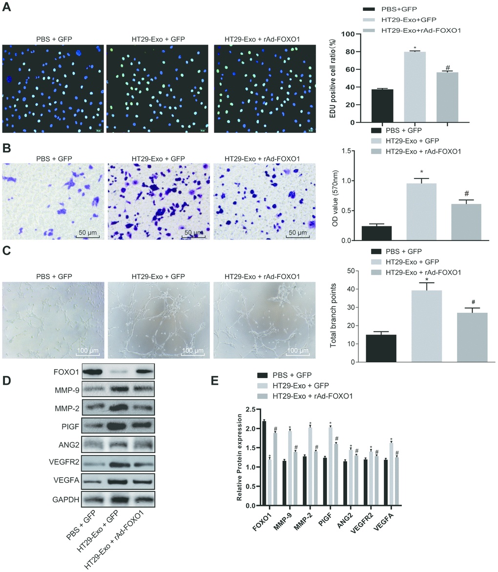 HT29 cell-derived exosomes promote proliferation, migration and tube formation abilities of HMEC-1 cells by inhibiting FOXO1. (A) EdU assay was applied to detect proliferation of HMEC-1 cells after treatment of HT29-Exo and rAd-FOXO1 (Scale bar = 50 μm); (B) HMEC-1 cell migration was detected by Transwell assay after treatment of HT29-Exo and rAd-FOXO1 (Scale bar = 50 μm); (C) tube formation abilities of HMEC-1 cell were detected by tube formation assay after treatment of HT29-Exo and rAd-FOXO1 (Scale bar = 100 μm); (D–E) expression of angiogenesis-related proteins (VEGFA, VEGFAR2, ANG2, PIGF, MMP-2 and MMP-9) and FOXO1 in HMEC-1 cells after treatment of HT29-Exo and rAd-FOXO1 was detected by western blot analysis; *p p 