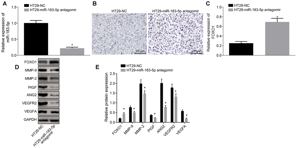 Inhibition of miR-183-5p in HT29 cells reduces the expression of FOXO1 and angiogenesis-related factors in nude mice. (A) expression of miR-183-5p in serum detected by RT-qPCR; (B, C) immunohistochemical detection of FOXO1 expression in tumor tissues of nude mice (Scale bar = 25 μm); (D–E) expression of angiogenesis-related proteins (VEGFA, VEGFAR2, ANG2, PIGF, MMP-2 and MMP-9) and FOXO1 in tumor tissues detected by Western blot analysis; *p t-test, n = 10.
