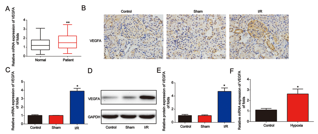 VEGFA expression was downregulated in AKI. (A) Analysis of VEGFA mRNA expression in serum from healthy controls and patients with AKI. GAPDH served as a reference control. (B) Immunohistochemical staining of VEGFA in kidney tissues from I/R rats. (C–E) VEGFA expression in I/R rat models. (F) VEGFA mRNA expression in NRK-52E cells exposed to hypoxia for 6 h. Eight rats were used in each group. Three independent experiments were performed. Error bars represent the mean ± SD of at least three independent experiments. *P 