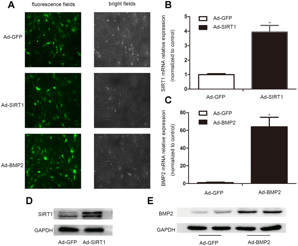 The successful infection of the C3H10T1/2 cells with Ad-SIRT1, Ad-BMP2, and Ad-GFP. (A) C3H10T1/2 cells were infected with Ad-SIRT1, Ad-BMP2, or Ad-GFP in plate cultures. Bright light and fluorescence microscopy (100X) examination showed the efficiency of recombinant adenoviruses after 24 h of virus infection. (B, C) Total RNA was isolated 24 h after infection, and the mRNA expression of SIRT1 and BMP2 was measured using real-time PCR. (D, E) The SIRT1 and BMP2 protein levels were measured after 48 h of infection using the western blotting method. The data are denoted as the mean ± SD.*: p 