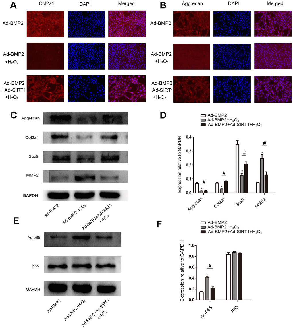 SIRT1 inhibited the decomposition of extracellular matrix in BMP2-induced-C3H10T1/2 cells under oxidative stress. (A, B) Immunofluorescence analysis of the expression of Col2a1 and aggrecan among the Ad-BMP2, Ad-BMP2+H2O2, and Ad-BMP2+Ad-SIRT1+H2O2 groups (200X). The Col2a1 and aggrecan proteins were labeled in red, and the nuclei were labeled in blue by DAPI staining. (C, D) The expression of Sox9, Col2a1, and aggrecan proteins decreased in the Ad-BMP2+H2O2 group compared with the Ad-BMP2 group, while the expression of Sox9, Col2a1, and aggrecan proteins increased in the Ad-SIRT1+Ad-BMP2+H2O2 group compared with that of the Ad-BMP2+H2O2 group. The expression of MMP2 increased in the Ad-BMP2+H2O2 group compared with that in the Ad-BMP2 group, while the expression of MMP2 in the SIRT1+BMP2+H2O2 group was significantly lower than that of the Ad-BMP2 group. (E, F) The expression of Ac-p65 and p65 among Ad-BMP2, Ad-BMP2+H2O2, and Ad-BMP2+Ad-SIRT1+H2O2 groups. The data are denoted as the mean ± SD. *: p 2O2 vs. Ad-BMP2; #: p 2O2 vs. Ad-BMP2+H2O2.