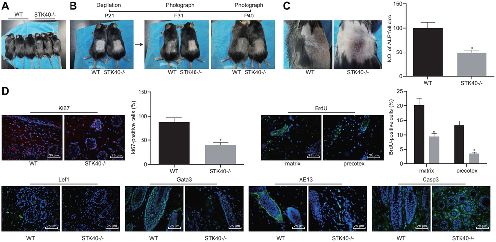 STK40 knockout inhibits HF keratinocyte differentiation and hair growth, but facilitated the apoptosis. (A) Hair loss conditions of STK40-/- mice at 30 days postnatal. (B) Delayed hair growth in STK40-/- mice. (C) HF neogenesis in STK40-/- mice and WT mice as determined by ALP staining. (D) Expression of the corresponding proliferation, differentiation, and apoptosis markers in the skin samples of STK40-/- and WT mice as detected by immunofluorescence assay (400 ×). * p vs. WT mice; Measurement data were expressed as mean ± standard deviation. Unpaired t test was adopted to analyze the differences between two experimental groups. n = 15.