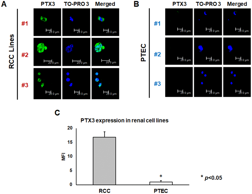 PTX3 expression in neoplastic (A) and proximal tubular epithelial cells (PTEC) (B) by confocal microscopy and quantification of specific fluorescence (C)