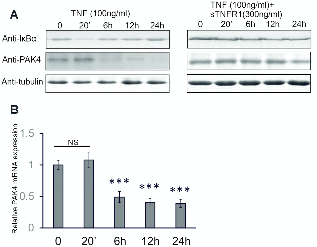 TNF decreases PAK4 gene and protein levels in HUVECs. (A) Western blot analysis of PAK4 and IκBα in HUVECs stimulated with 100 ng/ml TNF without and with 300 ng/ml soluble TNFR1. (B) Quantitative real-time PCR of PAK4 mRNA in HUVECs treated with 100 ng/ml TNF. All data are expressed as the mean + SD; *** P