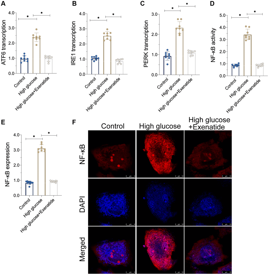 Exenatide reduces ER stress and the activation of NF-κB signaling pathway. (A–C) qPCR assay for ATF6, IRE1 and PERK transcription. (D) ELISA assay for NF-κB activity. (E–F) Immunofluorescence staining for NF-κB. *P