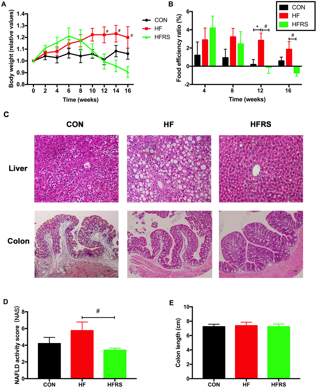 RS2 reduced body weight gain and liver NAFLD activity score in aged mice on high-fat diet. (A) Effects of diets on relative values of body weight every two weeks. (B) Monthly food efficiency ratio among the three groups. (C) Liver and colon histology on H&E staining slides (magnification, 200X) among the three groups. (D) Comparison of NAFLD activity scores calculated by the average score of three fields in each H&E staining slides (magnification, 400X). (E) Comparison of colon length among the three groups. n=5 or 6/group. Data are expressed as mean+SE. Differences were compared by one-way ANOVA among the three groups with Tukey’s multiple comparison posttests between the two groups. * p