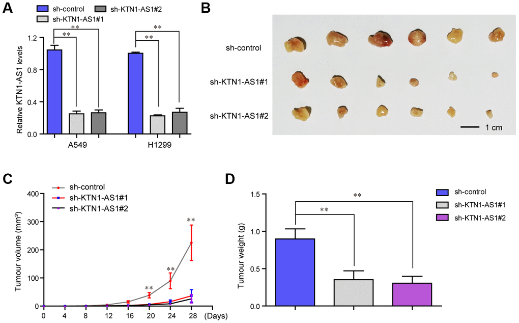 In vivo mice studies validated that KTN1-AS1 depletion suppressed tumor growth. (A) Relative expression of KTN1-AS1 in A549 and H1299 cells transfected with sh-KTN1-AS1 (sh-KTN1-AS1 #1 or sh-KTN1-AS1 #2) and scrambled shRNA. (B) The photographs and comparison of excised tumor sizes in A549 cells. (C) The tumor volume-time curves. (D) The tumor weights. * P 