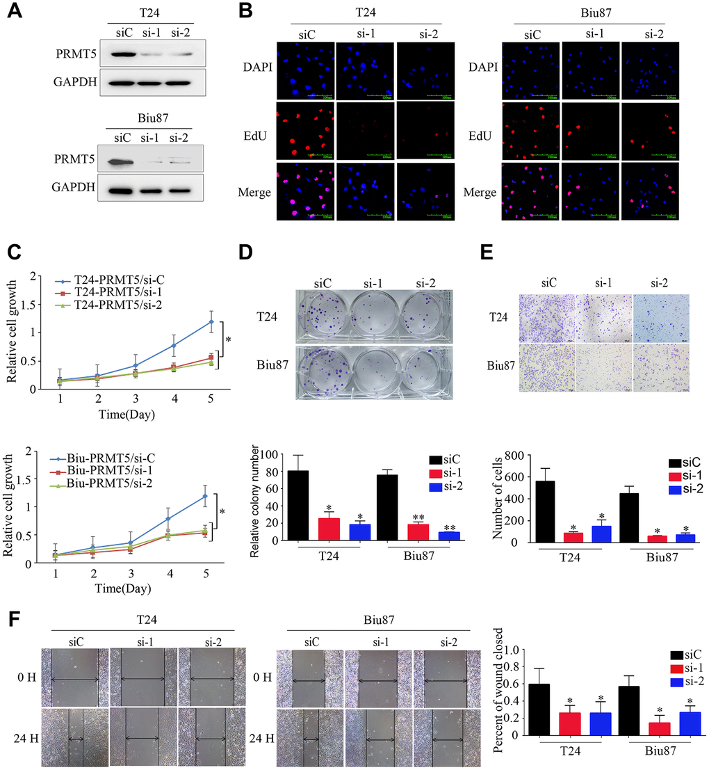 Downregulated expression of PRMT5 inhibited the proliferation and aggressiveness of bladder cancer cells. (A) PRMT5 was efficiently knocked down in T24-siRNA and Biu87-siRNA cells. (B–D) Cell proliferation was determined by EdU assay, CCK-8 assay, and colony formation assay of bladder cancer cells. (E, F) Cell invasion and migration capacities were determined using the transwell invasion assay and wound-healing assay for the indicated bladder cancer cells. Error bars show the standard error of the mean. siC: PRMT5-siRNA/negative control; si-1: PRMT5-siRNA/#1; si-2: PRMT5-siRNA/#2. *P P 