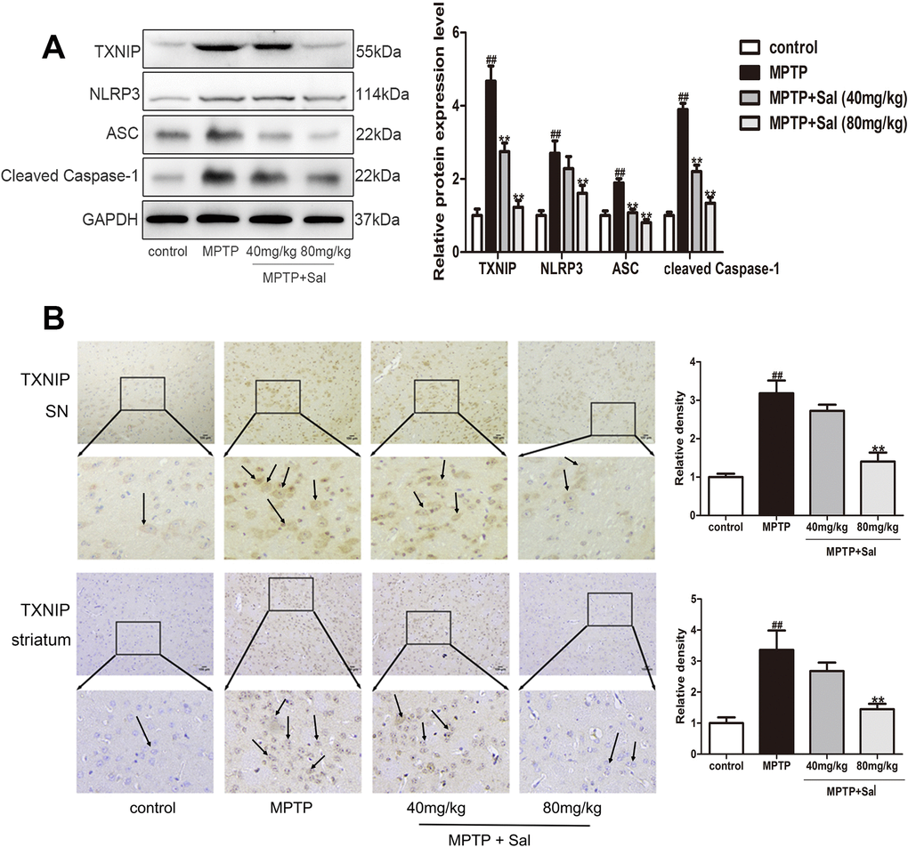 Sal inhibited pyroptosis via NLRP3/ASC/Caspase-1 signaling pathways in PD mice. (A) Sal inhibited TXNIP, NLRP3, ASC and cleaved Caspase-1 in SN and striatum of PD mice by western blotting (n = 3). (B) Sal inhibited TXNIP in SN and striatum by immunohistochemical staining. Original magnification: x200. All data are represented as mean ± SD. # P ## P 