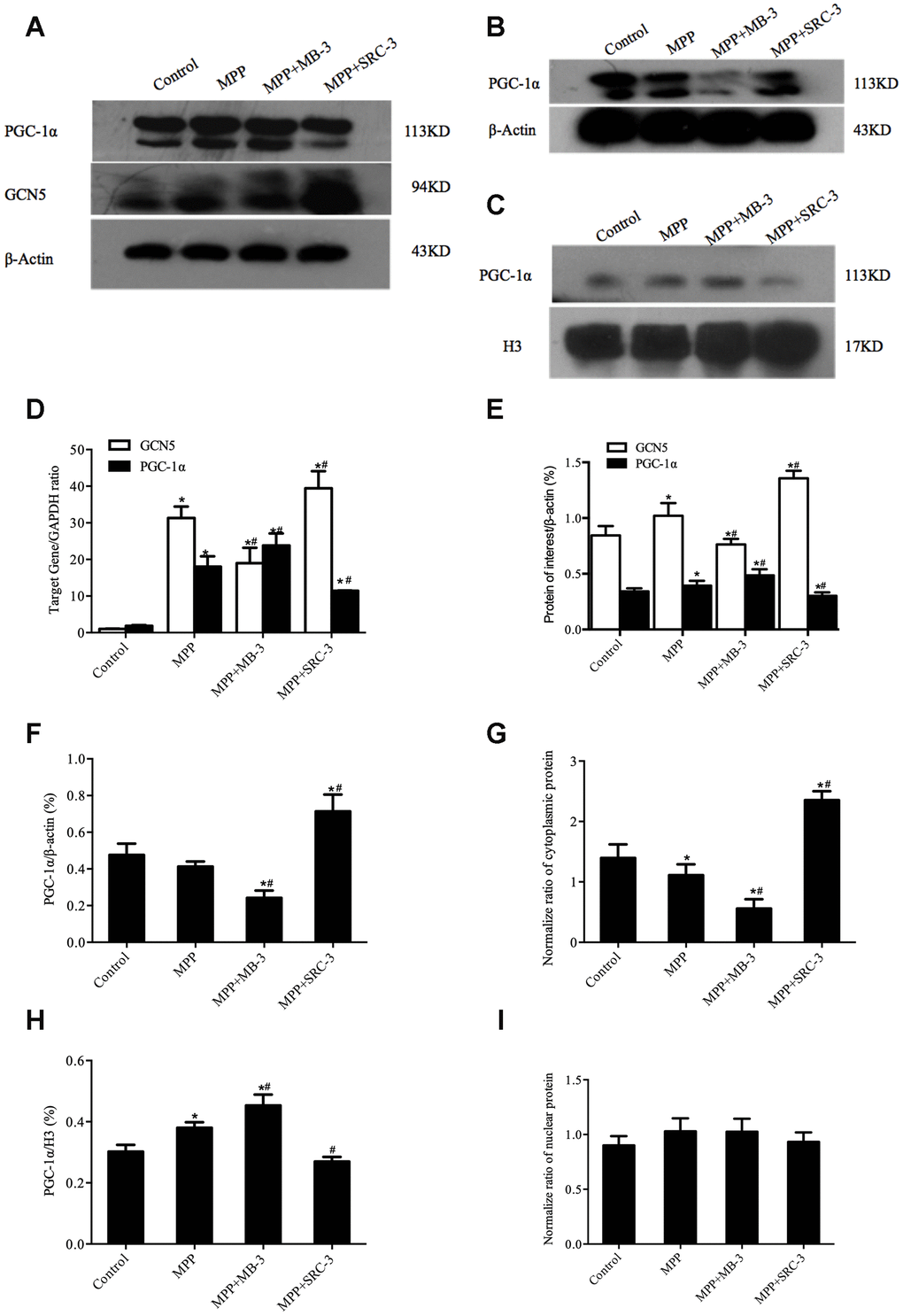 The cytosolic rather than the nuclear distribution of PGC-1α regulated by GCN5 in an MPP+-treated cell model. (A) The protein levels of GCN5 and PGC-1α; (B, C) The cytosolic levels of PGC-1α (B) and the nuclear levels of PGC-1α (C); (D) The relative transcriptional levels of GCN5 and PGC-1α normalized to GAPDH; (E) Semi-quantification of total GCN5 and PGC-1α proteins relative to β-actin; (F, H) Semi-quantification of the cytosolic (F) and the nuclear (H) PGC-1α proteins relative to β-actin; (G, I) The normalized cytosolic (G) and nuclear (I) proteins relative to the total protein; n=6, per group. * P vs. Control; # P vs. MPP+.