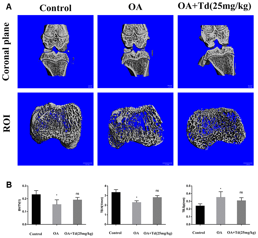 μ-CT evaluation of the subchondral bone at the tibial plateau in the OA model rats. (A) Representative images show the 3D μ-CT coronal views of the right knee and axial view of ROI from blank control, OA and experimental group rats. (B) Histogram plots show the analysis of trabecular structure analysis, including bone volume/tissue volume (BV/TV), trabecular number (Tb. N) and trabecular separation (Tb. Sp)in the blank control, OA and experimental group rats. *p 