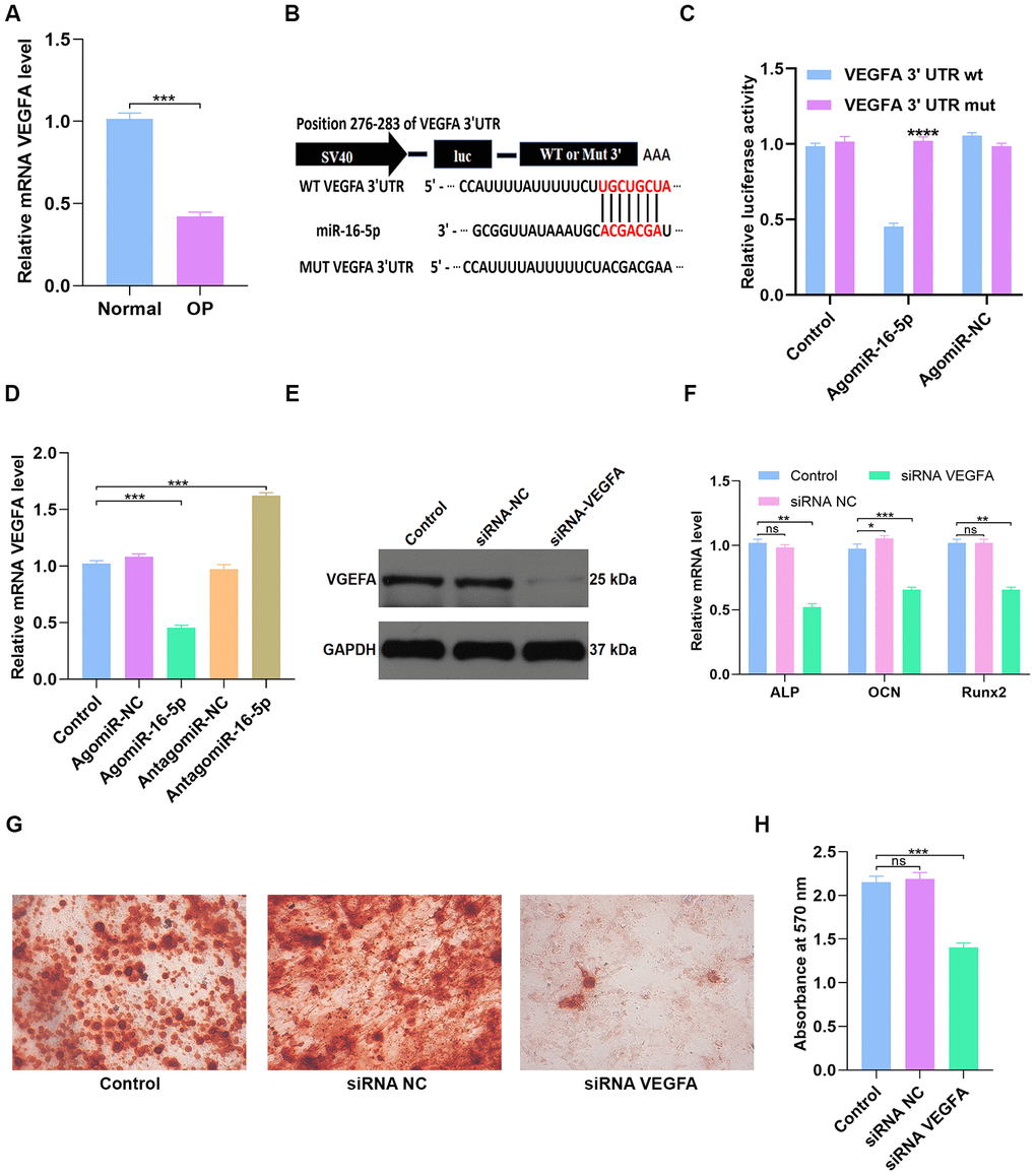 miR-16-5p directly targets VEGFA. (A) QRT-PCR analysis of VEGFA levels in postmenopausal patients with or without osteoporosis (n=10 per group). (B, C) Dual luciferase reporter assay results show firefly luciferase activity relative to Renilla luciferase activity in hMSCs transfected with dual luciferase vectors containing VEGFA-WT-3’UTR or VEGFA-MUT-3’UTR and miR-16-5p agonist (agomiR-16-5p) or negative control (agomiR-NC). (D) QRT-PCR analysis shows relative VEGFA mRNA levels in control hMSCs and hMSCs transfected with agomiR-NC, agomiR-16-5p, antagomiR-NC, and antagomiR-16-5p. (E) Western blotting analysis shows relative VEGFA protein levels expression in hMSCs transfected with siRNA-NC, and siRNA-VEGFA. (F) QRT-PCR analysis shows relative expression of osteogenic marker genes, ALP, OCN and RUNX2, in hMSCs transfected with siRNA-NC, and siRNA-VEGFA. (G, H) Alizarin red staining shows calcium deposition in hMSCs transfected with siRNA-NC, and siRNA-VEGFA for 21 days. Scale bar = 10 mm. The data are means ± SD. *p 