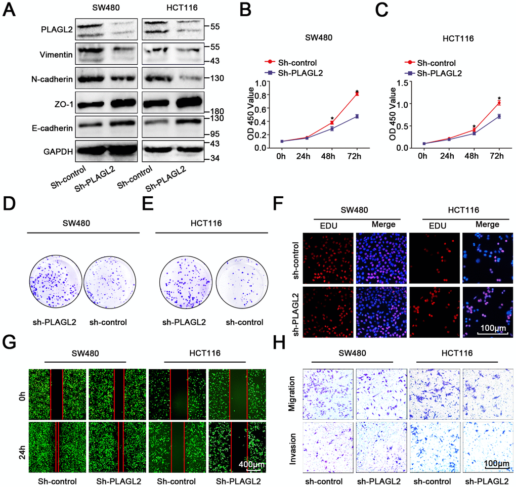 PLAGL2 accelerates CRC cell growth and migration. (A) WB indicated that downregulation of PLAGL2 could inhibit the expression of vimentin and N-cadherin and increase the expression of Zo-1 and E-cadherin. (B–C) CCK8 assays indicated that PLAGL2 promoted the proliferation of CRC cells. (D–E) Colony-formation assays indicated that PLAGL2 promoted the proliferation of CRC cells. (F) EDU assays indicated that PLAGL2 promoted the proliferation of CRC cells. (G–H) Transwell and wound-healing assays showed that PLAGL2 promoted the migration and invasion of CRC cells. The data are represented as the means±S.D. from at least three independent experiments. *p