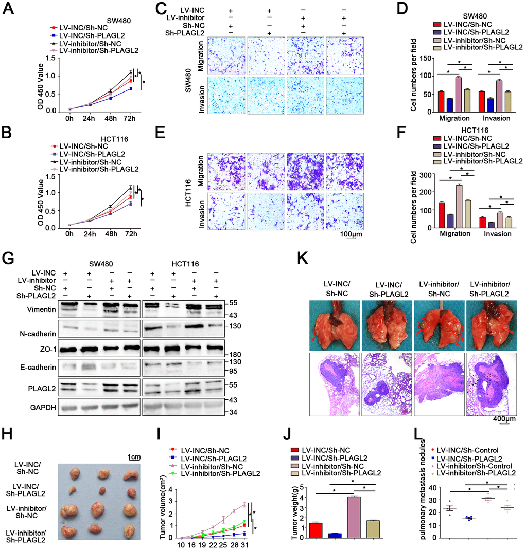 Silencing PLAGL2 significantly reverses the malignant process caused by the miR-214-3p inhibitor in CRC. (A–F) CCK8 and transwell assays indicated that PLAGL2 downregulation effectively reversed miR-214-3p inhibitor-induced proliferation (A–B) and the migration and invasion (C–F) abilities of CRC cells. (G) WB analysis revealed that the inhibitory effect of miR-214-3p on EMT was reversed by Sh-PLAGL2 transfection. (H–J) Silencing PLAGL2 reversed the effect of the miR-214-3p inhibitor on tumor growth in vivo. (K–L) Silencing PLAGL2 reversed the effect of the miR-214-3p inhibitor on tumor metastasis in vivo. The data are represented as the means±S.D. from at least three independent experiments. *p