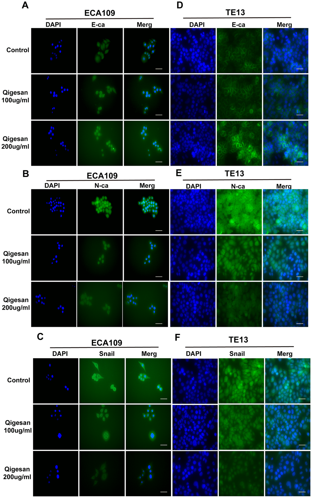 QGS inhibits EMT in esophageal cancer cells. (A–C) Immunofluorescence images showing E-ca, N-ca, and Snail1 localization in ECA109 cells. QSG dose-dependently increased E-ca expression and inhibited N-ca and Snail1 expression. (D–F) Immunofluorescence images of E-ca, N-ca, and Snail1 in TE13 showing the same trend after QSG stimulation. Scale bars indicate 10 μm.