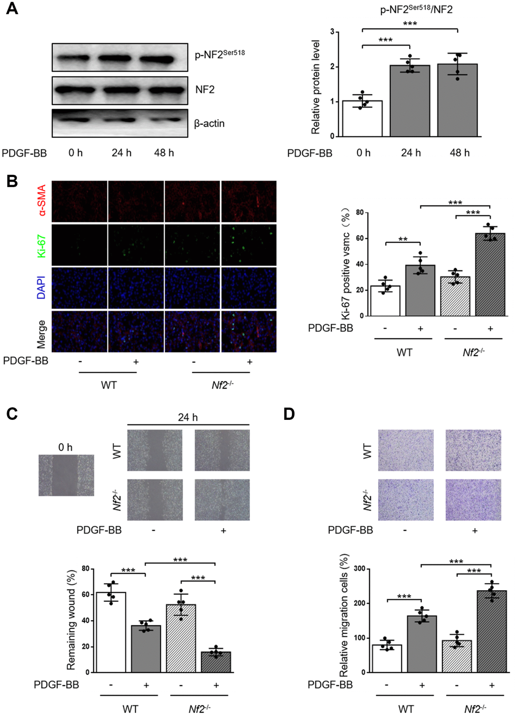 VSMC proliferation and migration in vitro is elevated after NF2 knockdown. (A) The relative protein expression levels of p-NF2Ser518 and NF2 were determined by immunoblotting in VSMC after 0, 24 and 48 h of physiological saline or PDGF-BB (30 ng/mL) treatment (n=5). (B) VSMC isolated from WT or Nf2-/- mice was stained with SM α-actin (red), Ki-67 (green) and DAPI (blue) after 48 h of physiological saline or PDGF-BB (30 ng/mL) treatment. Representative images (left) and corresponding quantification of Ki-67 positive VSMC (right) were shown (n=5). Magnification 400×. (C) Migration of VSMC isolated from WT and Nf2-/- mice after 24 h of physiological saline or PDGF-BB (30 ng/mL) treatment was measured via wound healing assay. Representative images (upper panel) and corresponding quantification of healing rates (lower panel) were shown (n=5). Magnification 100×. (D) VSMC isolated from WT or Nf2-/- mice after 8 h of physiological saline or PDGF-BB (30 ng/mL) treatment was assessed by transwell assay. Representative images (upper panel) and corresponding quantification of migration cells (lower panel) were shown (n=5). Magnification 100×. Data are shown as mean ± S.D. **PP
