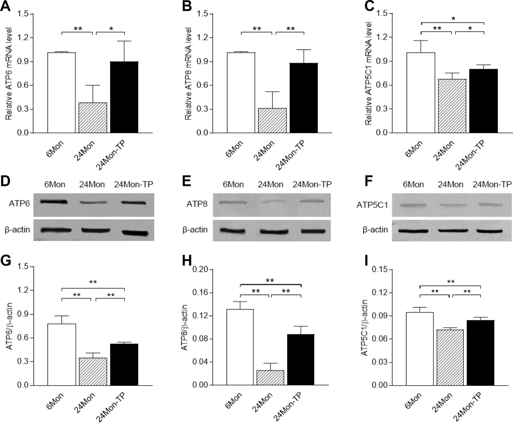 Effects of TP supplementation on complex V subunit expression in the substantia nigra of aged male rats. (A–C) The mRNA levels of ATP6, ATP8 and ATP5C1 were calculated using the 2-ΔΔCt method. GAPDH was used as an internal control. (D–F) Representative Western blots of ATP6, ATP8 and ATP5C1 protein levels. (G–I) ATP6, ATP8 and ATP5C1 protein levels were quantified by comparing the band density of each protein to that of β-actin (endogenous control). Data are expressed as the mean ± S.D. (n=6 rats/group). *P**P