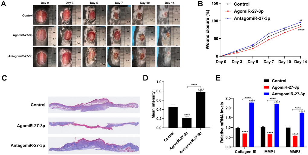Downregulation of miR-27-3p promotes wound healing in vivo. (A) Digital photo of wounds treated with PBS, agomiR-27-3p, or antagomiR-27-3p. (B) Rate of wound-closure of the three groups. (C) Masson’s trichrome staining of wound sections treated with PBS, agomiR-27-3p, or antagomiR-27-3p. (D) Quantitative analysis of the mean intensity of Masson-stained areas in the three groups. (E) qRT-PCR evaluating the level of collagen 3, MMP1 and MMP3 expression. n=5. *p