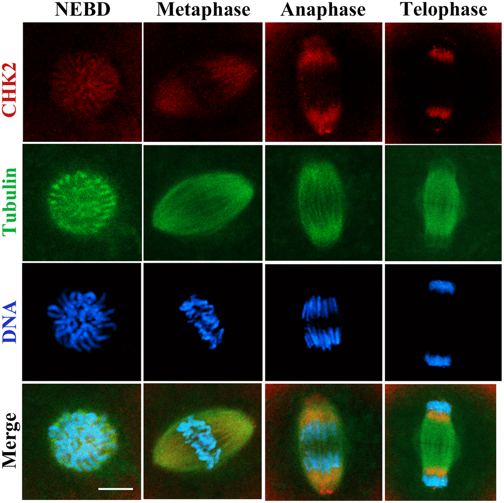 The localization of CHK2 during early embryonic development in mice. Embryos at first cleavage were immunolabeled with anti-α-tubulin (green) and anti-CHK2 (red) antibodies, and Hoechst 33342 was used to label DNA (blue). CHK2 was localized near chromosomes after NEBD, and CHK2 accumulated at the spindle area at metaphase, while CHK2 was localized at the spindle poles at anaphase and telophase. Bar = 5 μm.