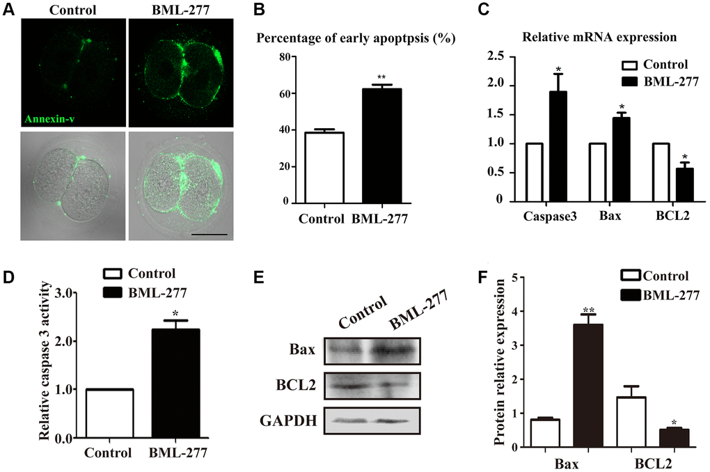 Inhibition of CHK2 induced apoptosis during early embryonic development in mice. (A) Embryos at the 2-cell stage were stained with Annexin-V (green). The Annexin-V signal was stronger in embryos in the CHK2 inhibition group. Bar = 30 μm. (B) The percentages of cells in early apoptosis in mouse embryos treated with BML-277 and mouse embryos in the control group (62.2 ± 2.52%, n = 64, 25 μM vs. 38.6 ± 1.77%, n =92, control, p C) The expression of apoptosis-related genes in the 25 μM treatment group and control group. (D) Relative Caspase 3 activity in embryos in the control and CHK2 inhibition groups. (E) The protein expression of Bax and BCL2 in embryos in the control and CHK2 inhibition groups was determined by immunoblotting. (F) Band intensity analysis of Bax and BCL2 in the two groups. **significant difference (p 