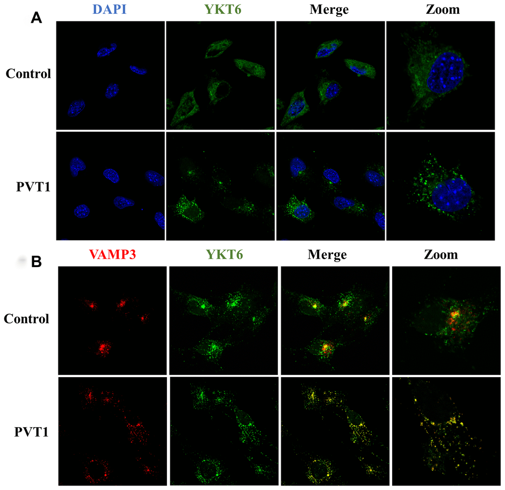 PVT1 regulates the translocation of YKT6 and VAMP3. (A) Analysis of YKT6 (green) in PVT1-overexpressing HS766T cells, as determined by confocal microscope. Nuclei were labeled with DAPI (blue). (B) Analysis of YKT6 (green) and VAMP3 (red) in PVT1-overexpressing HS766T cells, as determined by confocal microscope.