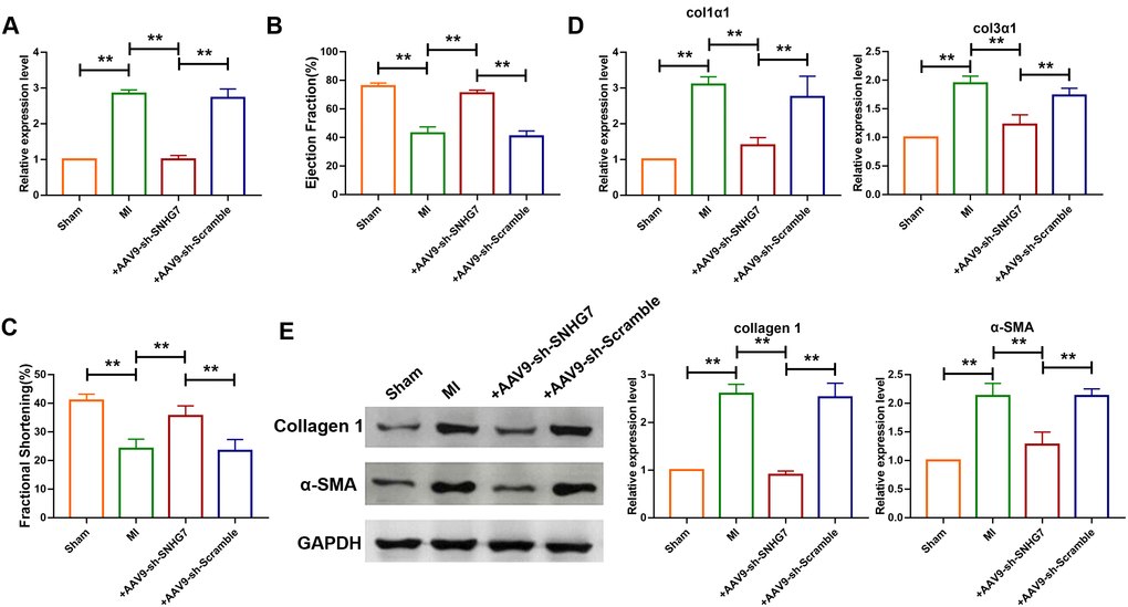Silencing of SNHG7 inhibited cardiac remodeling after MI. (A) qRT-PCR analysis showing that AAV9-sh-SNHG7 reversed the up-regulation of SNHG7 in MI mice; GAPDH mRNA served as an internal control, and AAV9-sh-scramble served as an additional control. Data was presented as mean ± SEM; one-way ANOVA was used for the statistical analysis. n=6 mice per group. (B, C) 4 weeks after MI, echocardiographic findings showed that the silencing of SNHG7 improved ejection fraction (EF) and fraction shortening (FS). Data was presented as mean ± SEM; one-way ANOVA was used for the statistical analysis. n=12 mice per group. (D) mRNA expression of collagen 1α1 and collagen 3α1 were measured by qRT-PCR; GAPDH mRNA served as an internal control. Data was presented as mean ± SEM; one-way ANOVA was used for the statistical analysis. n=10 mice per group. (E) Western blotting analysis showing elevation of protein levels of collagen 1 and α-SMA in peri-infarcted tissue of left ventricle of mice after MI. Data was presented mean ± SEM; one-way ANOVA was used for the statistical analysis. n=5 mice per group. **P