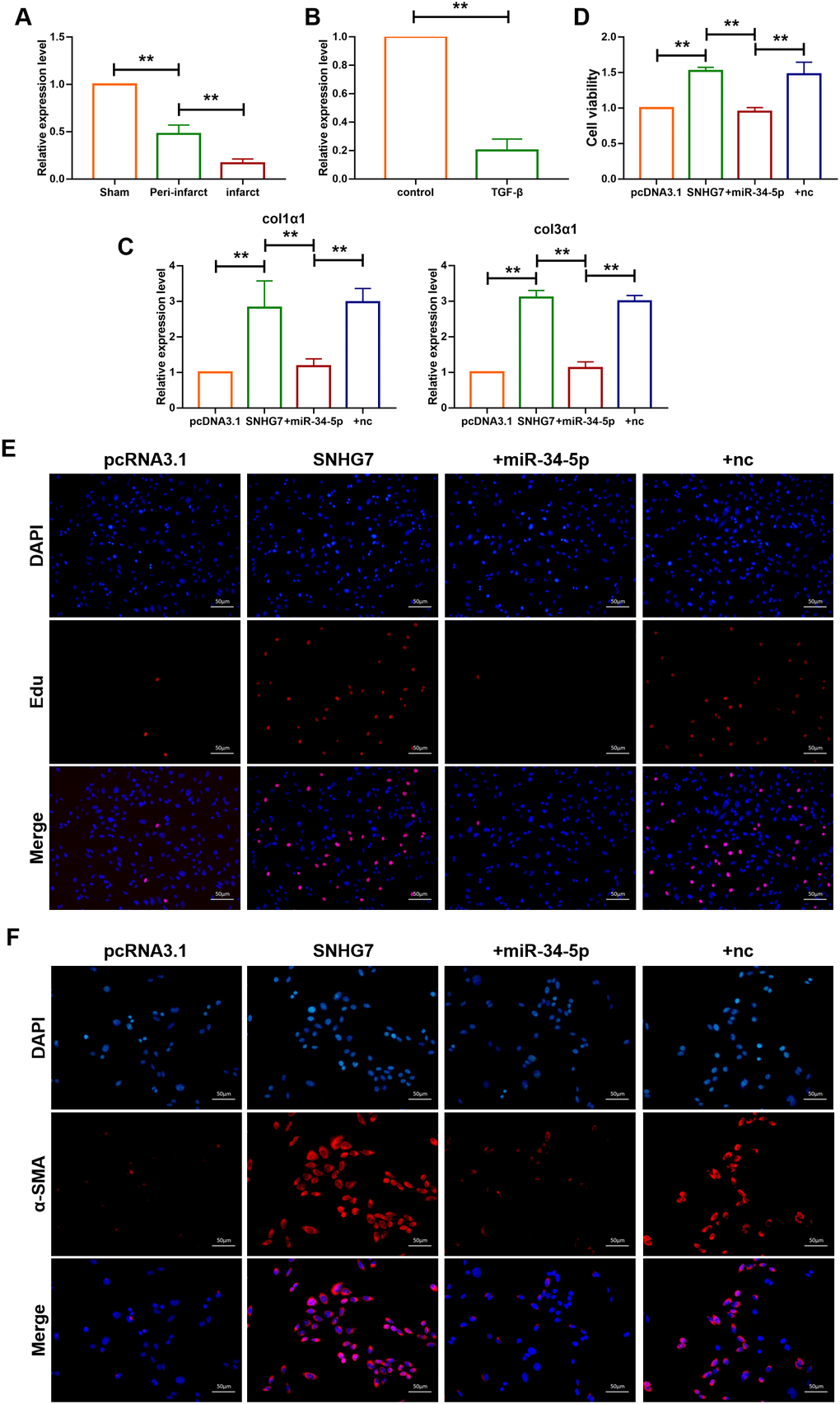 lncRNA SNHG7 promoted cardiac fibrosis by targeting miR-34-5p. (A) qRT-PCR analysis showing downregulation of miR-34-5p in the peri-infarcted and infarcted areas of left ventricle of mice after MI. U6 served as an internal control. Data was presented as mean ± SEM; two-tailed t test was used for the statistical analysis. n=5 mice per group. (B) qRT-PCR analysis showing reduction of miR-34-5p in cardiac fibroblasts after treatment with TGF-β1 (10 ng/mL) for 24h. Data was presented as mean ± SEM; two-tailed t test was used for the statistical analysis. n=5 independent cell cultures. (C) mRNA expression of collagen 1α1 and collagen 3α1 were measured by qRT-PCR. Forced expression of SNHG7 (1 μg/mL) in cardiac fibroblasts increased mRNA expression levels of collagen 1α1 and collagen 3α1, which were reversed by miR-34-5p overexpression; GAPDH mRNA served as an internal control. Data was presented as mean ± SEM; one-way ANOVA was used for the statistical analysis. n=6 mice per group. (D) MTT assay for the assessment of cell viability. Transfection of SNHG7 with or without miR-34-5p in normal cardiac fibroblasts. Data was presented as mean ± SEM; two-tailed t test was used for the statistical analysis. n=5 independent cell cultures. (E) EdU staining for the assessment of cell proliferation in cardiac fibroblasts overexpressing SNHG7 in the presence or absence of miR-34-5p mimics. Scale bars represented 50 μm. (F) Representative images of immunofluorescence staining showing that forced expression of SNHG7-induced fibroblast-myofibroblast transition. Scale bars represent 50 μm. **P