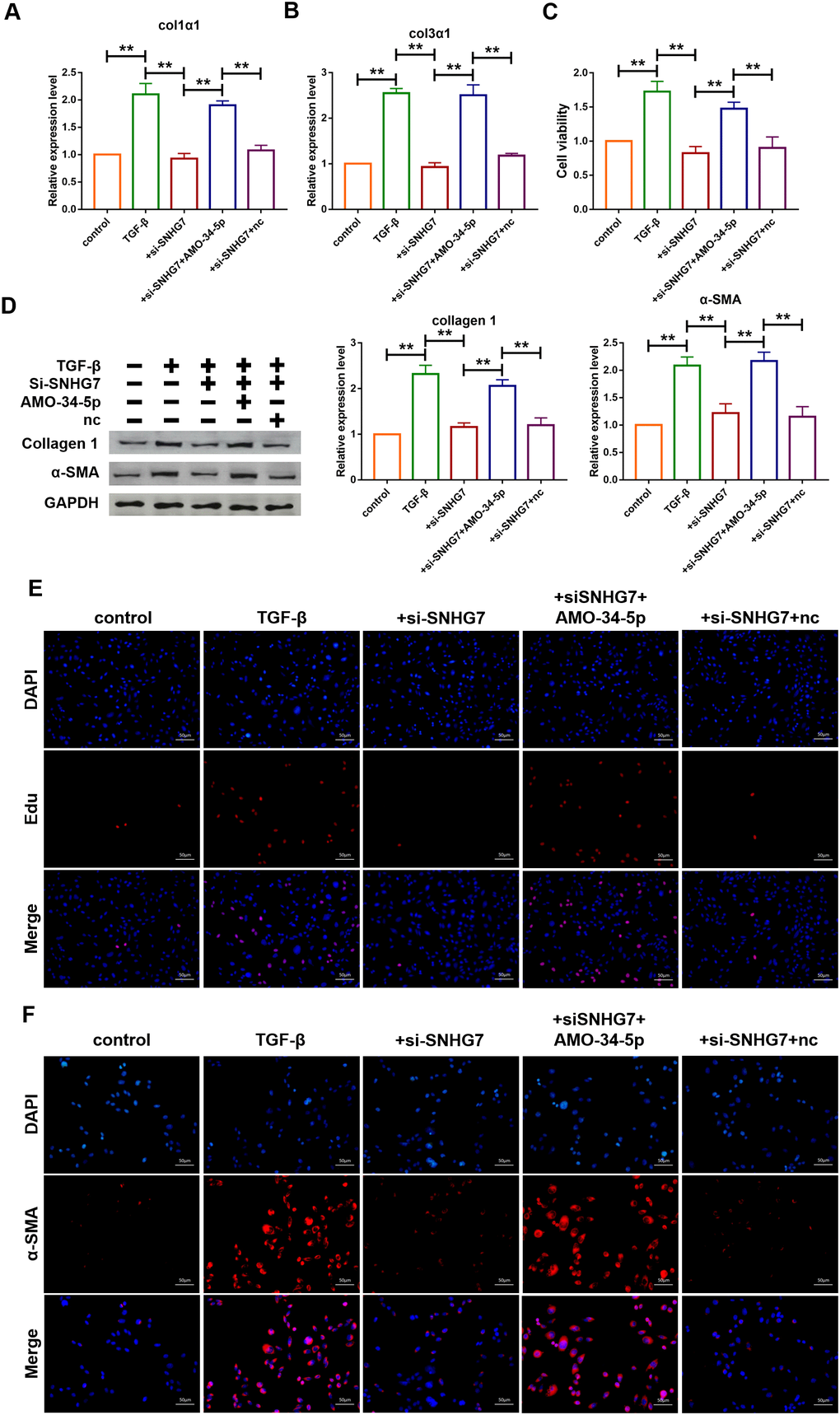 Silencing of lncRNA SNHG7 alleviated TGF-β1-induced fibrogenesis in cardiac fibroblasts. (A, B) Suppression of SNHG7 attenuated the increase in collagen 1α1 and collagen 3α1 expression induced by TGF-β1, as measured by qRT-PCR; GAPDH mRNA served as an internal control. Data was presented as mean ± SEM; one-way ANOVA was used for the statistical analysis. n=5 independent cell cultures. (C) Western blotting analysis showing that knockdown of SNHG7 attenuated TGF-β1-induced fibrotic protein expression (Collagen I and α-SMA); GAPDH served as a loading control. Data was presented as mean ± SEM; one-way ANOVA was used for the statistical analysis. n=5 independent cell cultures. (D) MTT assay for the assessment of cell viability. Transfection of si-SNHG7 with or without AMO-34-5p in cardiac fibroblasts treated with TGF-β1 for 24h. Data was presented as mean ± SEM; one-way ANOVA was used for the statistical analysis. n=5 independent cell cultures. (E) EdU staining for the assessment of cell proliferation in cardiac fibroblasts inhibiting SNHG7 in the presence or absence of AMO-34-5p mimics. Scale bars represented 50 μm. (F) Representative images of immunofluorescence staining showing that knockdown of SNHG7 abated the TGF-β1-induced fibroblast-myofibroblast transition, which was promoted by AMO-34-5p. Scale bars represented 50 μm. **P