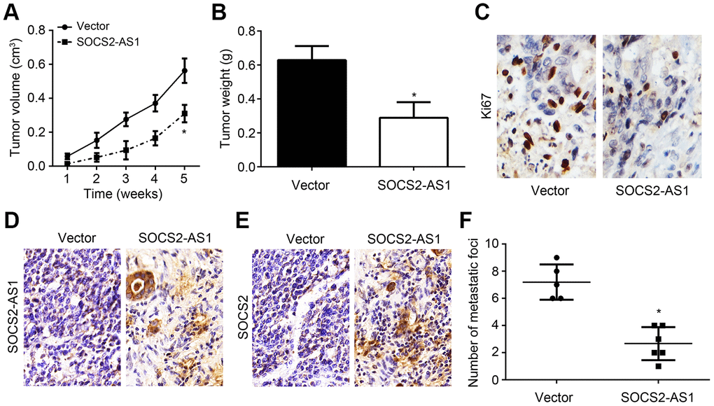 In vivo effects of SOCS2-AS1 overexpression on CRC growth and metastasis. (A) Tumor volumes were measured every week. (B) Tumor weights were determined after 5 weeks. (C) Ki67 expression was analyzed by IHC in tumor tissues. (D) Expression of SOCS2-AS1 in tumor tissues was measured by ISH. (E) Expression of SOCS2 was evaluated by IHC. (F) Number of metastatic foci in liver was analyzed. *P