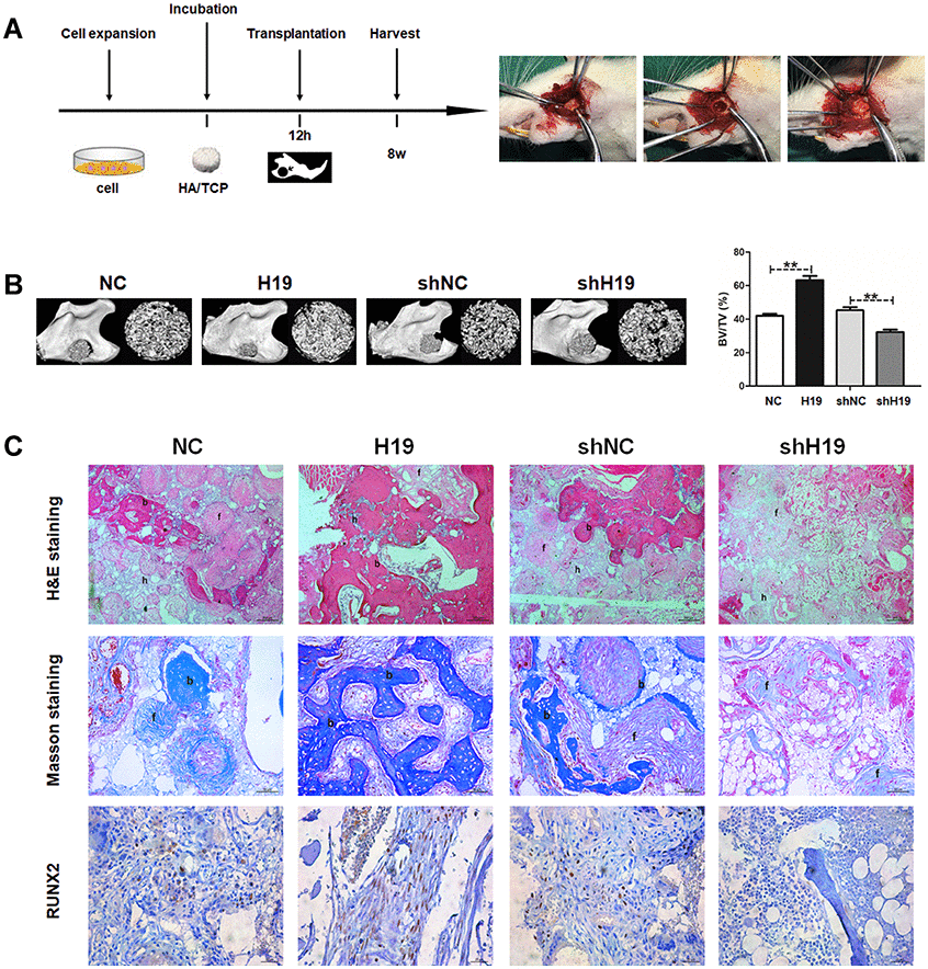 LncRNA-H19 in HAMSCs promotes osteogenesis in vivo. (A) NC, H19, shNC and shH19 groups were transplanted subcutaneously into a rat critical-sized mandibular defect model for 8 weeks. (B) Reconstructed 3D micro-CT images of the tissue-engineered bone and percentages of BV/TV. (C) H&E staining, Masson staining and immunohistochemical staining of RUNX2 in NC, H19, shNC and shH19 groups. b: bone-like tissues, h: HA/TCP scaffold, f: fibrous. Scale bar, 200 μm. Data are shown as mean ± SD. **P 