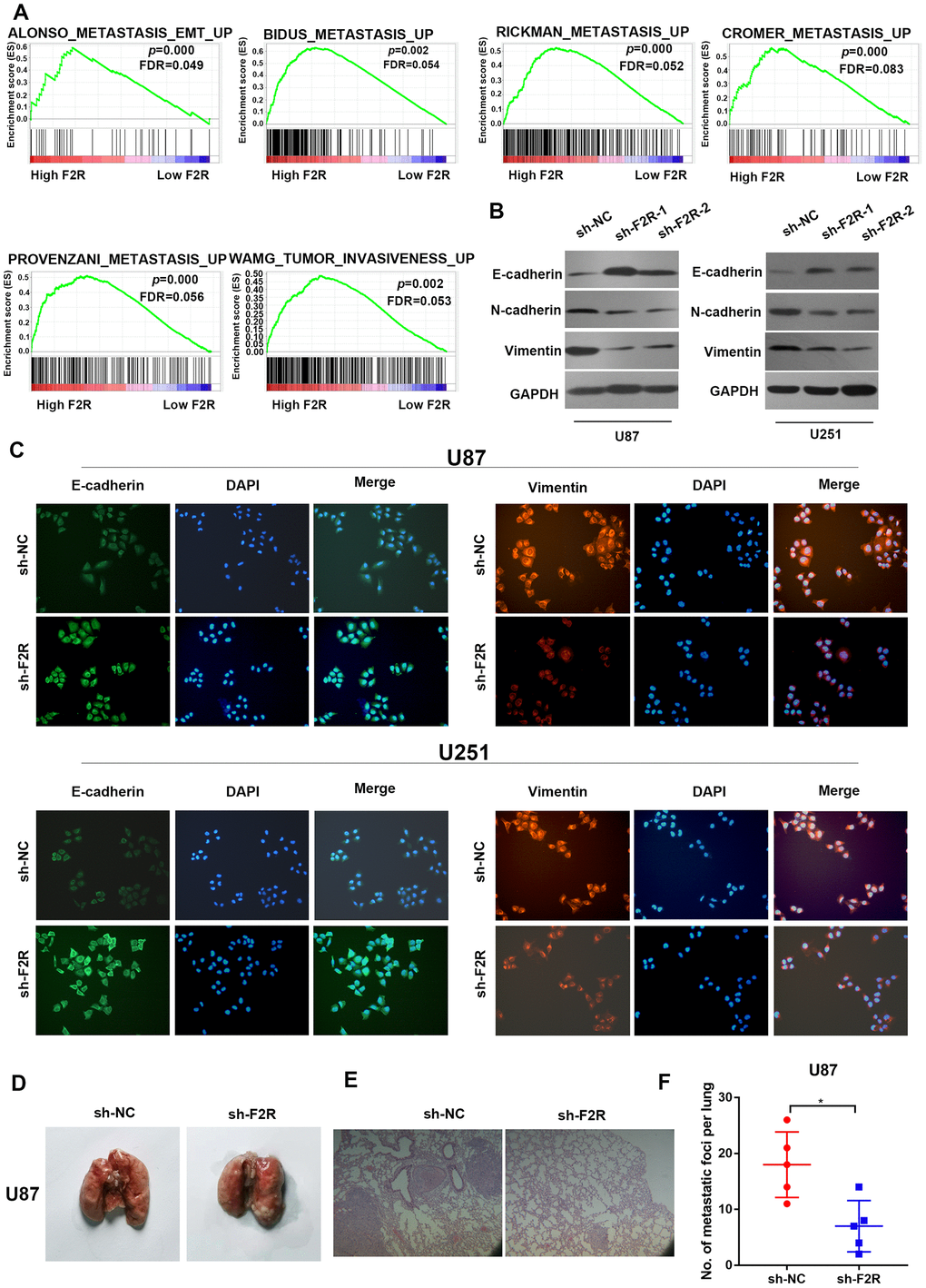 F2R promotes glioma cell epithelial-mesenchymal transition (EMT) in vitro. (A) GSEA enrichment plots showed that enrichment of metastasis-related pathways was associated with up-regulation of F2R. (B) Western blot analysis revealed that knocking down F2R inhibited the epithelial-mesenchymal transition process. (C) Immunofluorescence staining of E-cadherin and Vimentin in U87 and U251 cells with F2R knockdown. (D) Representative images of metastatic lung in each group. (E) Representative HE images of metastatic lung in each group. Scale bar, 100 mm. (F) lung metastasis areas in each group. All experiments were repeated at least three times. Data are presented as the mean ± SEM. *P
