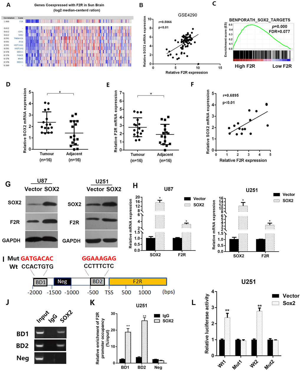 SOX2 transcriptionally activates F2R expression. (A) By resorting to the data collected from Sun glioblastoma dataset (GSE4290), we picked out top-ranked genes co-expressed with F2R. (B) The co-expression of SOX2 and F2R was validated using data from GSE4290. Correlation coefficient r=0.5066, PC) GSEA analysis based on the TCGA glioma database revealed that F2R was associated with SOX2 targets. (D, E) The mRNA expression level of SOX2 and F2R were detected in 16 paired glioma and adjacent normal tissues using RT-PCR. (F) The correlation of SOX2 and F2R was validated using RT-PCR. Correlation coefficient r=0.6895, PG, H) The protein and mRNA level of F2R were measured under the condition of SOX2 overexpression in U87 and U251 cell lines. (I) Transcription factor online prediction analysis revealed two SOX2 binding site in the promoter region of F2R. A random region without SOX2 binding sites acted as a negative control (Neg). (J, K) ChIP result using anti-IgG antibody and anti-SOX2 antibody. (L) Relative luciferase activity of the control or F2R overexpression glioma cells. All experiments were repeated at least three times. Data are presented as mean ± SEM. *P