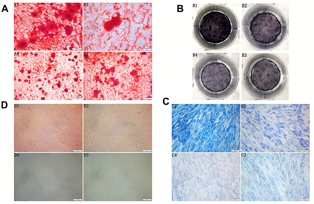 (A) Morphology observation of the third generation PDLSCs after twenty-one days of osteogenic induction alizarin red staining(200×) (A1: Control Group; A2: Cells were treated with 10ng/mL TNF-α; A3: Cells were treated with 100μg/mL AGEs-BSA A4: Cells were treated with 100μg/mL AGEs-BSA and 10ng/mL TNF-α). (B) ALP staining of the third generation PDLSCs after twenty-one days of osteogenic induction (B1: Control Group; B2: Cells were treated with 10ng/mL TNF-α; B3: Cells were treated with 100μg/mL AGEs-BSA; B4: Cells were treated with 100μg/mL AGEs-BSA and 10ng/mL TNF-α). (C) Morphology observation of the third generation PDLSCs after twenty-one days of chondrogenic induction toluidine blue staining(200×) (C1: Control Group; C2: Cells were treated with 10ng/mL TNF-α; C3: Cells were treated with 100μg/mL AGEs-BSA; C4: Cells were treated with 100μg/mL AGEs-BSA and 10ng/mL TNF-α). (D) Morphology observation of the third generation PDLSCs after 21 days of adipogenic induction oil red O staining(100×) (D1: Control Group; D2: Cells were treated with 10ng/mL TNF-α; D3: Cells were treated with 100μg/mL AGEs-BSA; D4: Cells were treated with 100μg/mL AGEs-BSA and 10ng/mL TNF-α).