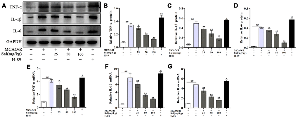 Sal inhibits MCAO/R-induced inflammatory cytokine secretion. (A–D) Optical density analysis of the TNF-α, IL-1β and IL-6 proteins. (E–G) QPCR results of TNF-α, IL-1β and IL-6 expression. Values are expressed as the mean ± SD. #p ##p *p **p 