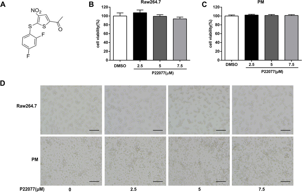 P22077 does not affect cell viability. (A) The chemical structure of P22077. (B, C) The cytotoxicity of P22077 in Raw264.7 cells (B) and mouse peritoneal macrophages (PM) (C). (D) Raw264.7 cells and peritoneal macrophages plated treated by different concentrations of P22077 for 12h, the morphology of the cells observed under the microscope. Scale bars, 100μm. Similar results were obtained from three independent experiments and data were presented as mean ± SD of one representative experiment.