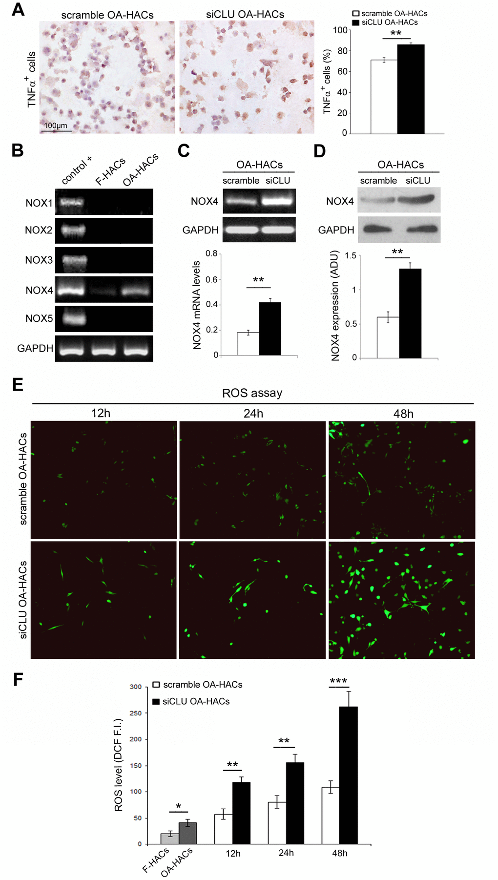 Effects of CLU silencing on TNFα and ROS levels in cultured OA chondrocytes. (A) Representative immunocytochemical images and evaluation of TNFα+ cytospinned OA-HACs after 72 hours of CLU silencing. (B) Basal mRNA expression of NOX isoforms by RT-PCR in cultured chondrocytes. (C, D) RT-PCR and blot analysis of NOX4 expression in scramble and CLU-silenced OA-HACs. (E, F) Representative images and quantitative measurement of ROS levels (green fluorescence) after 12, 24 and 48 hours of CLU silencing compared with control (scramble) and HACs from fractured patients; original magnification, 100X. Data are expressed as mean values ± SEM of three independent experiments (each using pooled samples from n=3 donors) performed in triplicate. Abbreviations: F-HACs, fractured patient human articular chondrocytes; OA-HACs, OA-Human articular chondrocytes; ADU, arbitrary densitometric unit; F.I., fluorescence intensity. Student’s t-test: *P P P 