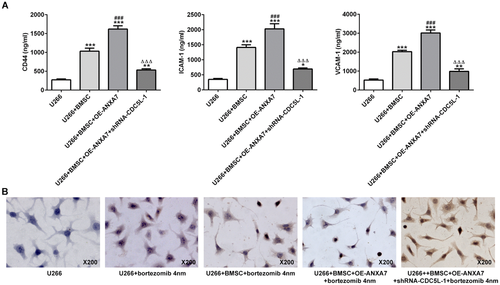 CDC5L interference inhibits the CAM-DR promotion effect of ANXA7. (A) The levels of CD44, ICAM1 and VCAM1 in U266 co-cultured with BMSC after transfection were detected by ELISA assay. *P###PΔΔΔPB) The apoptosis of U266 cells treated with bortezomib in co-culture system was determined by TUNEL assay.
