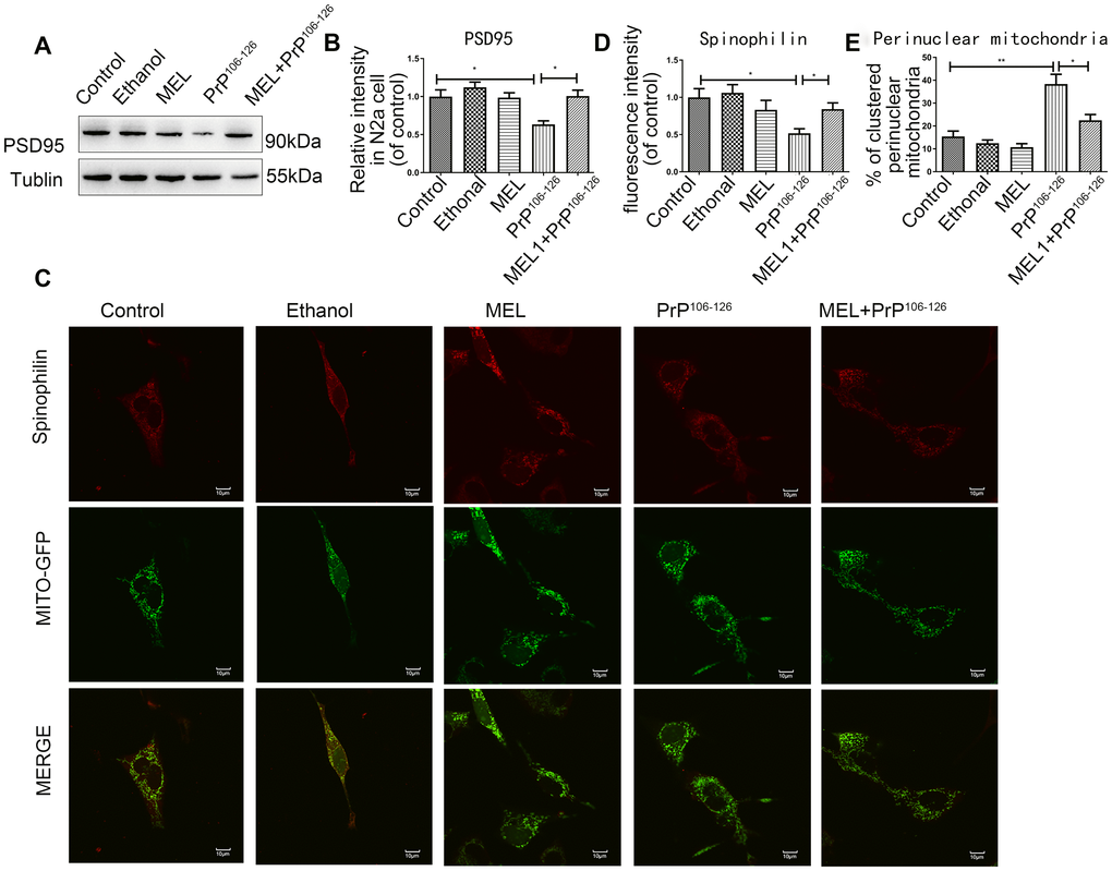 Melatonin reduced synapse damage in PrP106-126-treated N2a cells. (A, B) Protein expression of PSD95 by Western blotting. (C) Representative images of mitochondria (Original magnification 600×). (D) Quantification of spinophilin. (E) Cells with clustered perinuclear mitochondria *P 