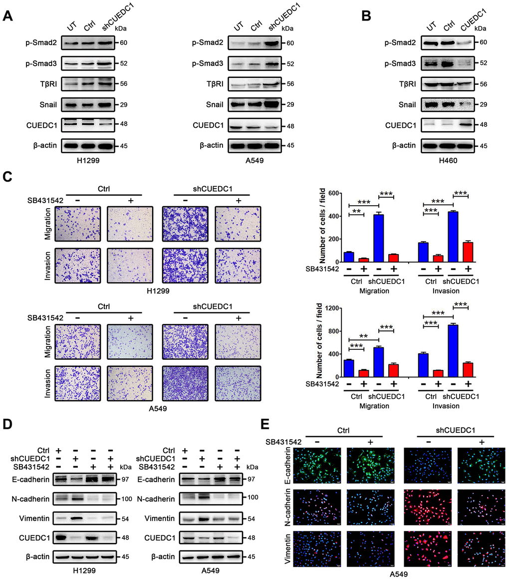 CUEDC1 regulates TβRI/Smad signaling pathway. (A, B) Western blotting analysis of components of the TβR I/Smad signaling pathway and Snail in NSCLC cells. (C) The migration and invasion ability of shRNA/CUEDC1 or negative control in H1299 and A549 cells, with or without SB431542 treatment, was detected using transwell assays. P values were calculated using Student’s t-test. (D) H1299 and A549 cells stably transfected with CUEDC1-shRNA or empty vector were treated with 10 μM SB431542 for 24 h, and EMT markers was determined by immunoblotting. (E) CUEDC1-knockdown A549 cells or negative control A549 cells were treated with or without SB431542 for 24 h. Cells were immunostained with the indicated antibodies against EMT marker proteins. Experiments were performed at least three times. The data are expressed as the mean ± SEM; *P P P 