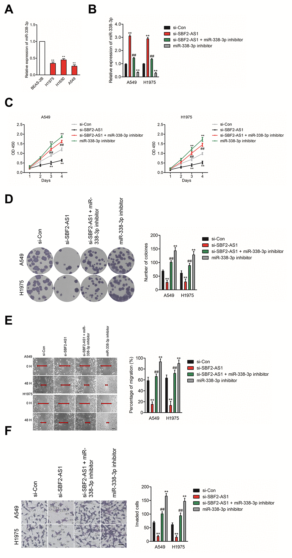 Knockdown of SBF2-AS1 suppresses NSCLC cell proliferation and invasion by targeting miR-338-3p. (A) qRT-PCR analysis of miR-338-3p expression in human bronchial epithelial cell BEAS-2B and NSCLC cell lines (A549, H1650 and H1975). **PB) A549 or H1975 cell was transfected with si-Con, si-SBF2-AS1 or si-SBF2-AS1 and miR-338-3p inhibitor. The expression levels of miR-338-3p in different groups were analyzed by qRT-PCR. (C) Cell proliferation activity of A549 or H1975 cell was assessed by CCK-8 assay. (D) Cell proliferation activity of A549 or H1975 cell was assessed by cell colony formation assay. (E) Cell migration ability of A549 or H1975 cell in different groups was analyzed by wound healing assay. (F) Cell invasion ability of A549 or H1975 cell in different groups was analyzed by Transwell invasion assay. The data are presented as the mean ± SD. All in vitro data are representative of three independent experiments. **P##P